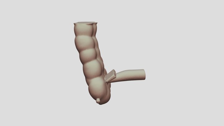 Ileoseko anastamosis 3D Model