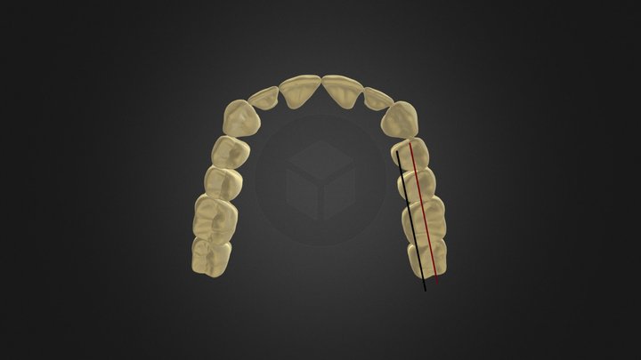 3_upper teeth alignment 3D Model