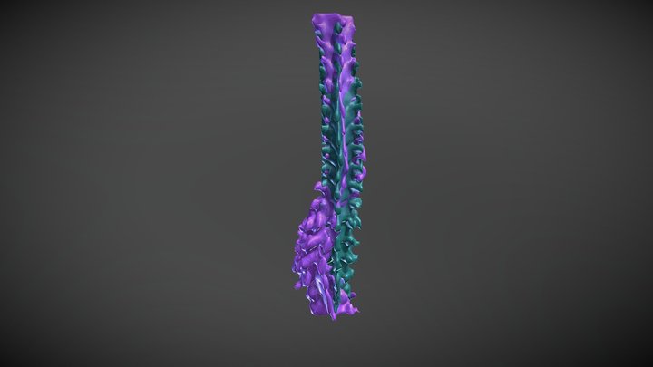 Straight and Curvy Spine Overlay 3D Model