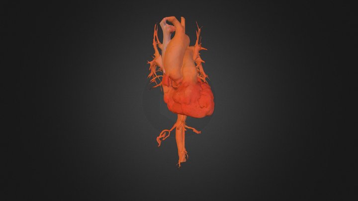 Reconstruction: Heart and vessels 3D Model