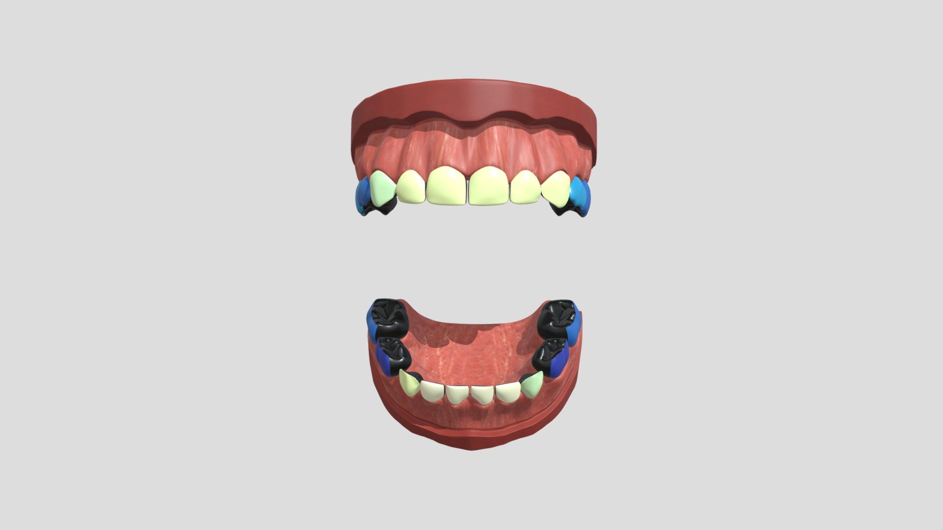 diff_nzunrestored_3cm_2c
