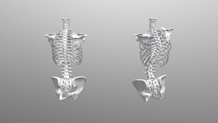 Spine Compare 3D Model