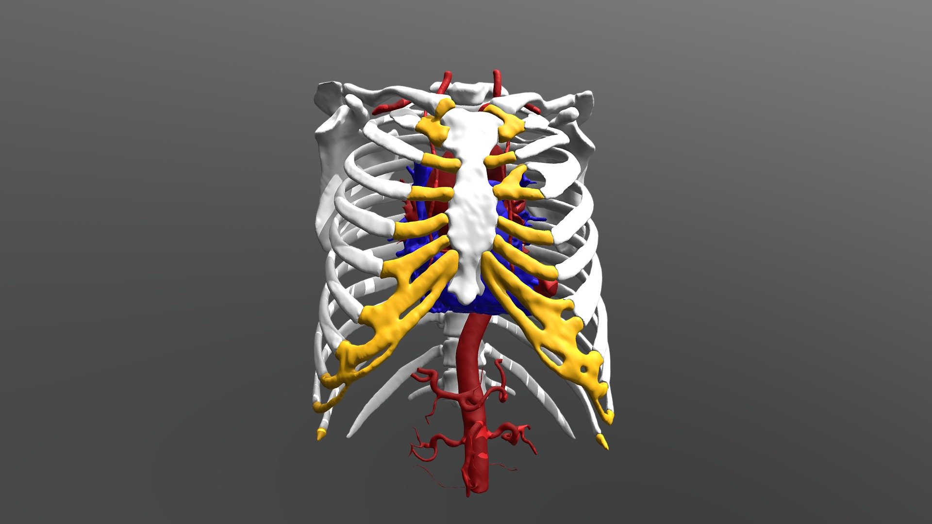 Female Thorax with bifurcated rib 3D model by valchanov [baf9221