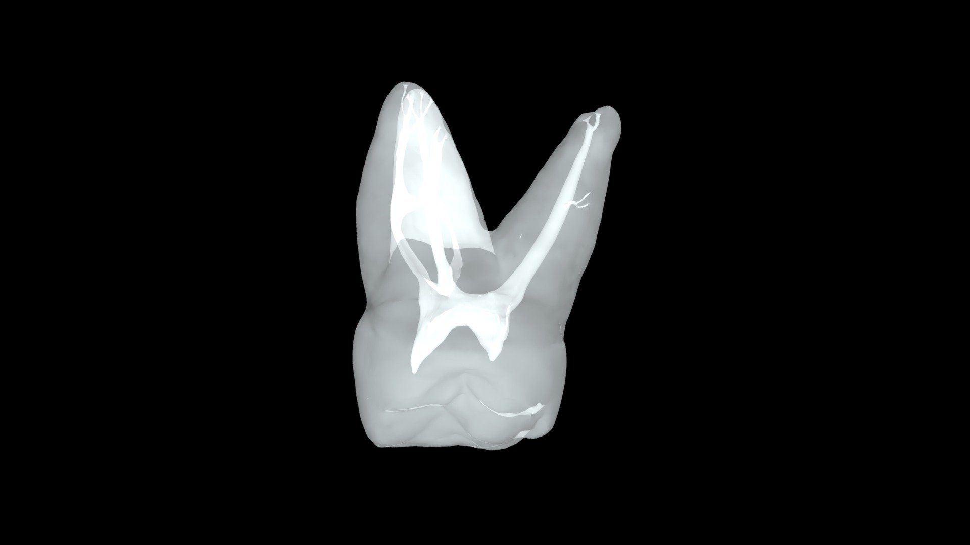 Maxillary Molar #3 - 3D model by biomed3d [bb2f616] - Sketchfab