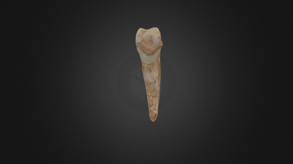Tooth Reduced