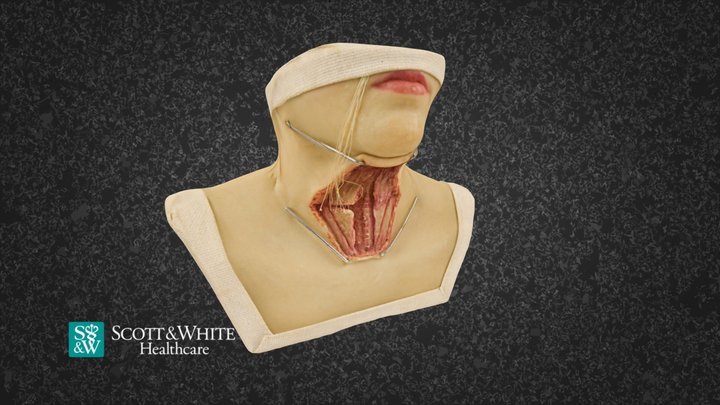 Thyroidectomy Surgery - 11 3D Model