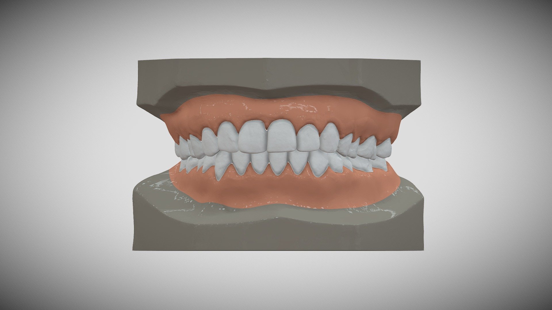 Dental 3D MODEL