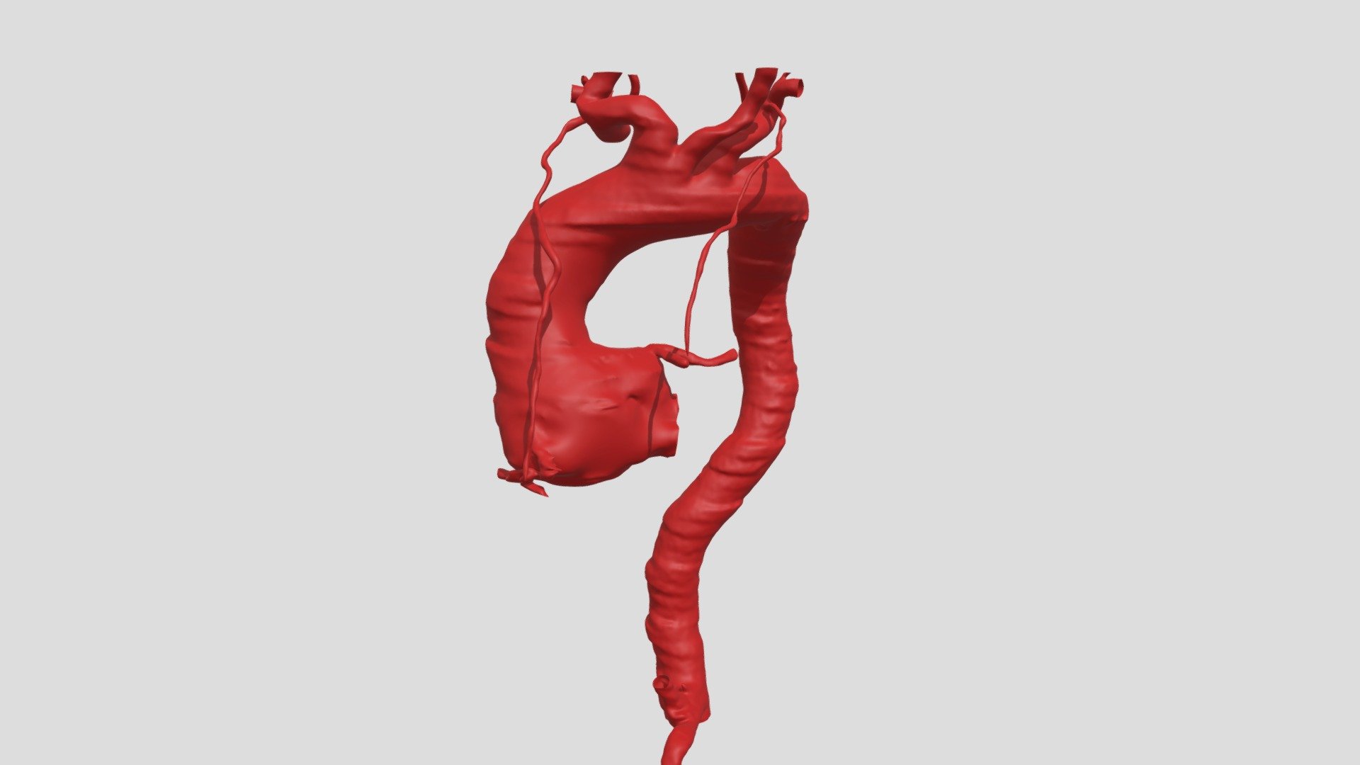 A29HCJU27082021_AORTA01