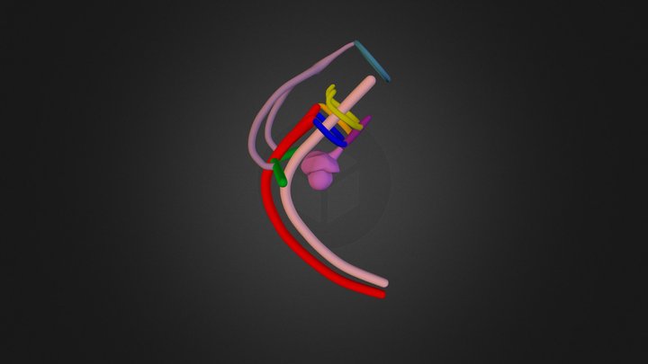 LAA Retroesophageal RSCA Stage 2 3D Model