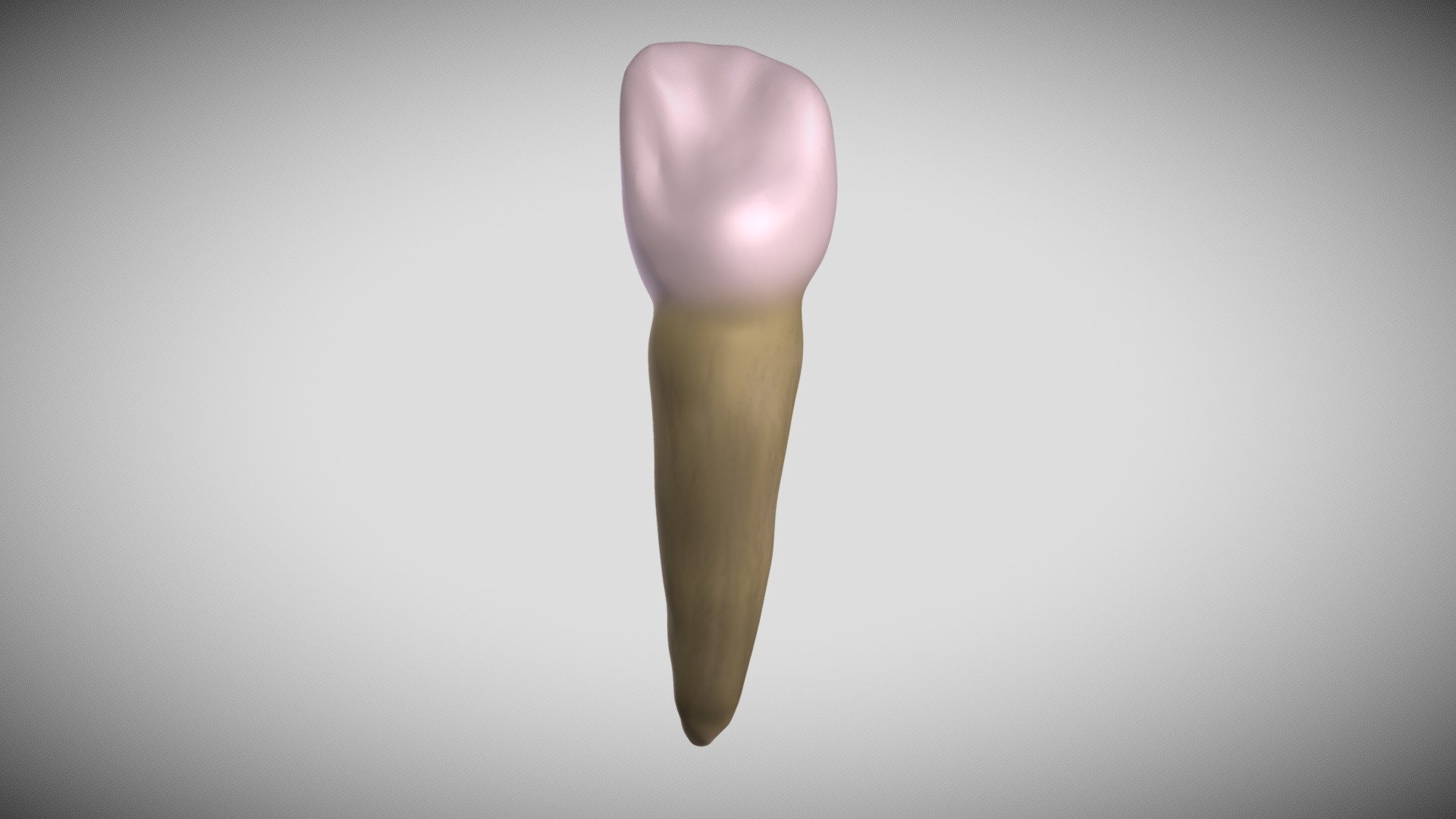 Lateral