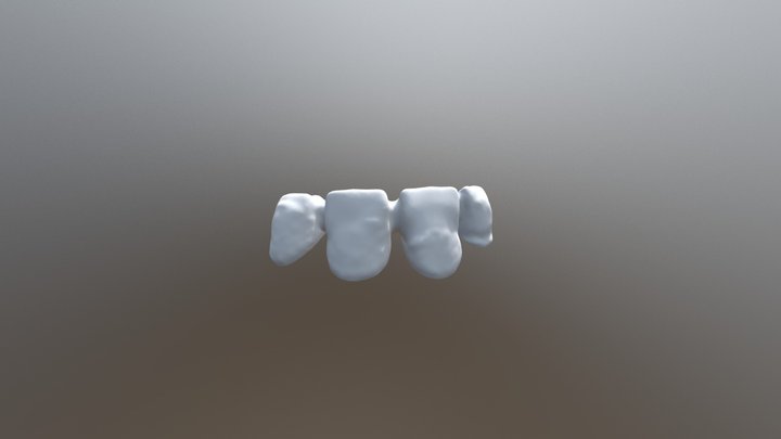 2018-03-16 00002-065-12-11-21-22-bridge Slm Cad 3D Model