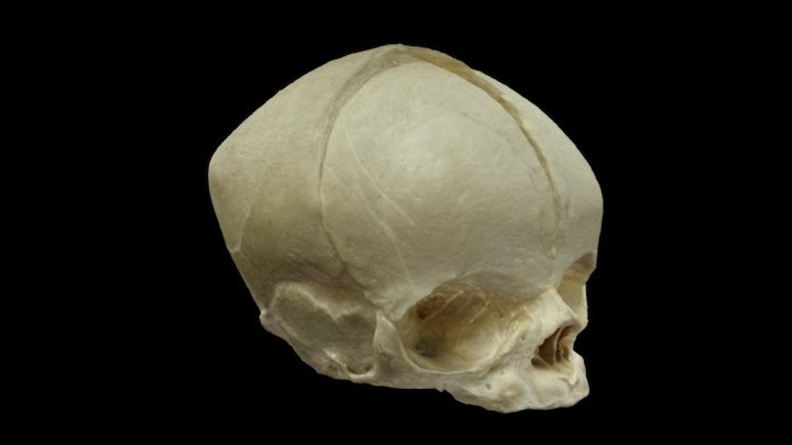 Human Fetal Skull 3D Model