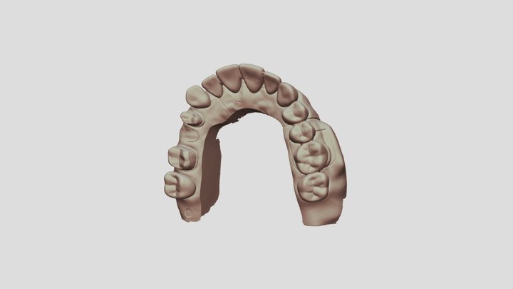 2 Upper Jaw Scan 3D Model