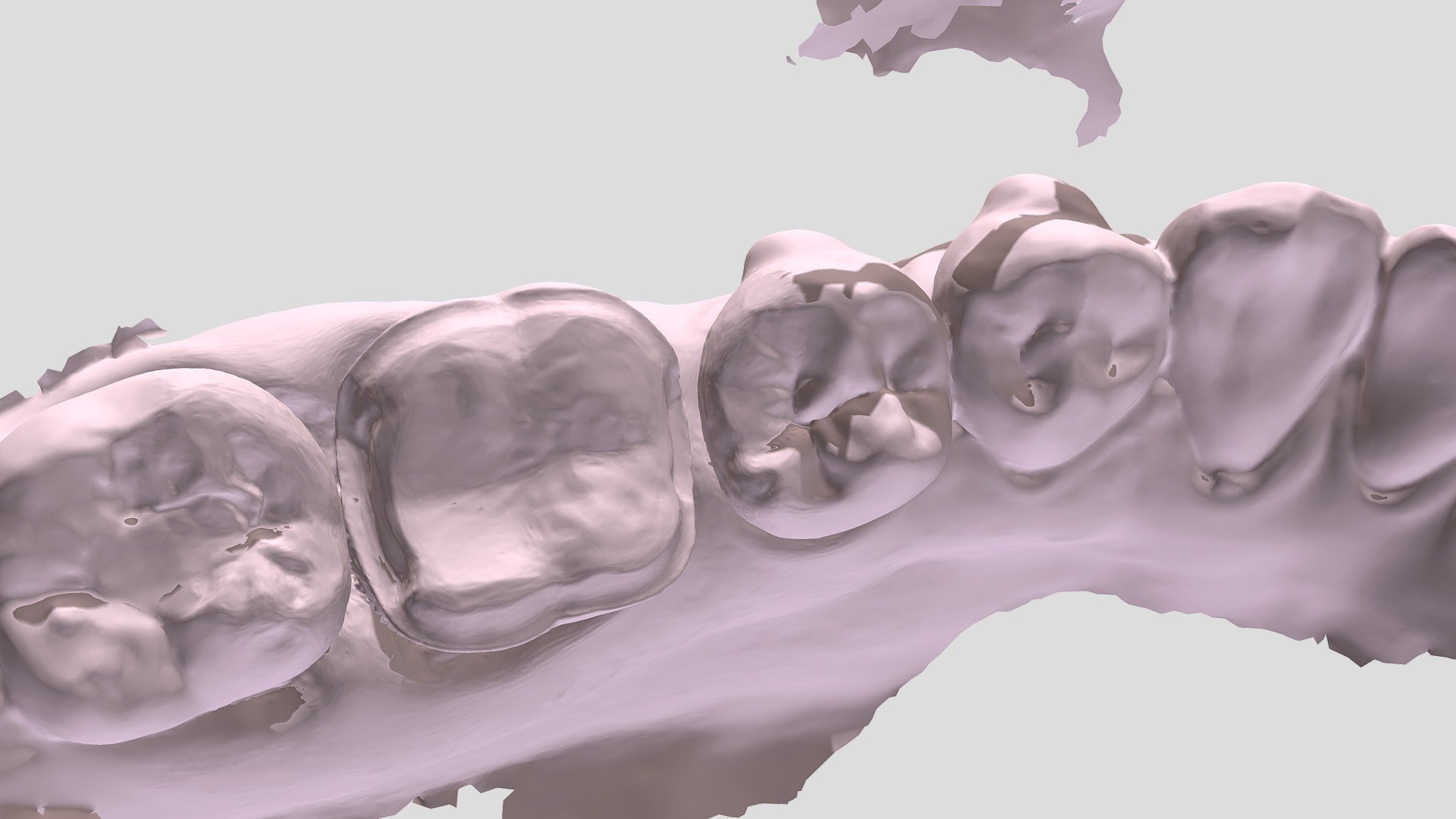 彭 Lower Jaw Scan