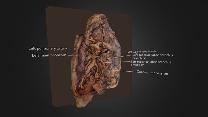 Lung With Annotations 3D Model