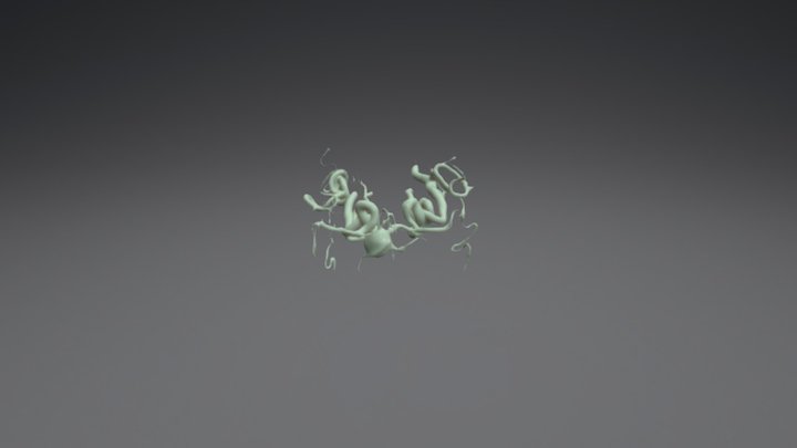 Aneurysm Vasculature 3D Model