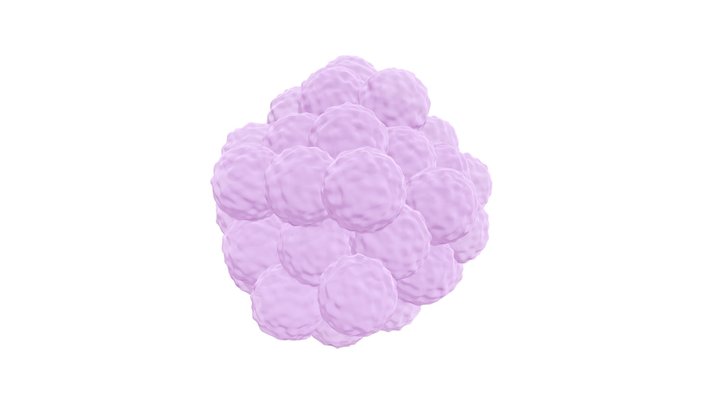 tumor mass 3D Model