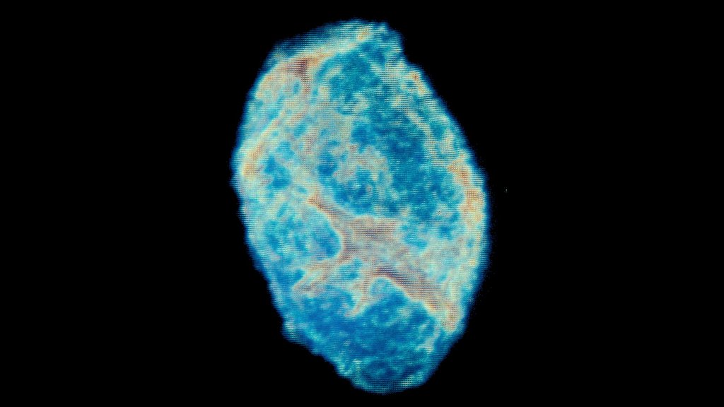 Forensic Imaging - A 3D model collection by Terrie Simmons-Ehrhardt ...