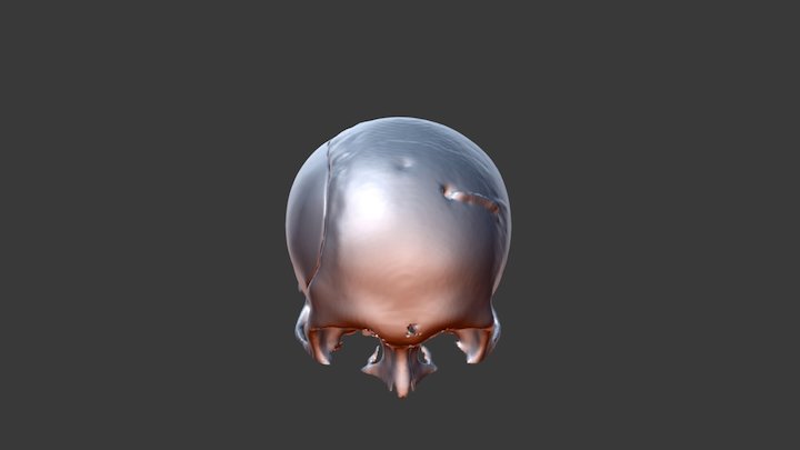 Prótesis - Craneo 3D Model