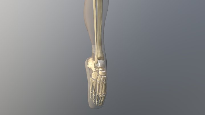 Metatarsal stress fractures over-pointe 3D Model