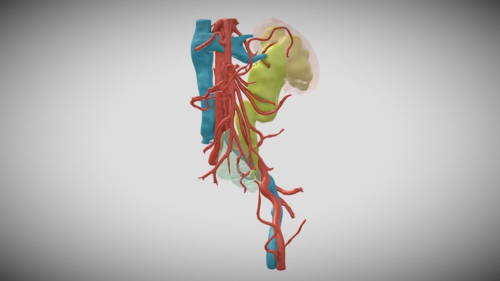 Esclerosis post radioterapia 3D Model