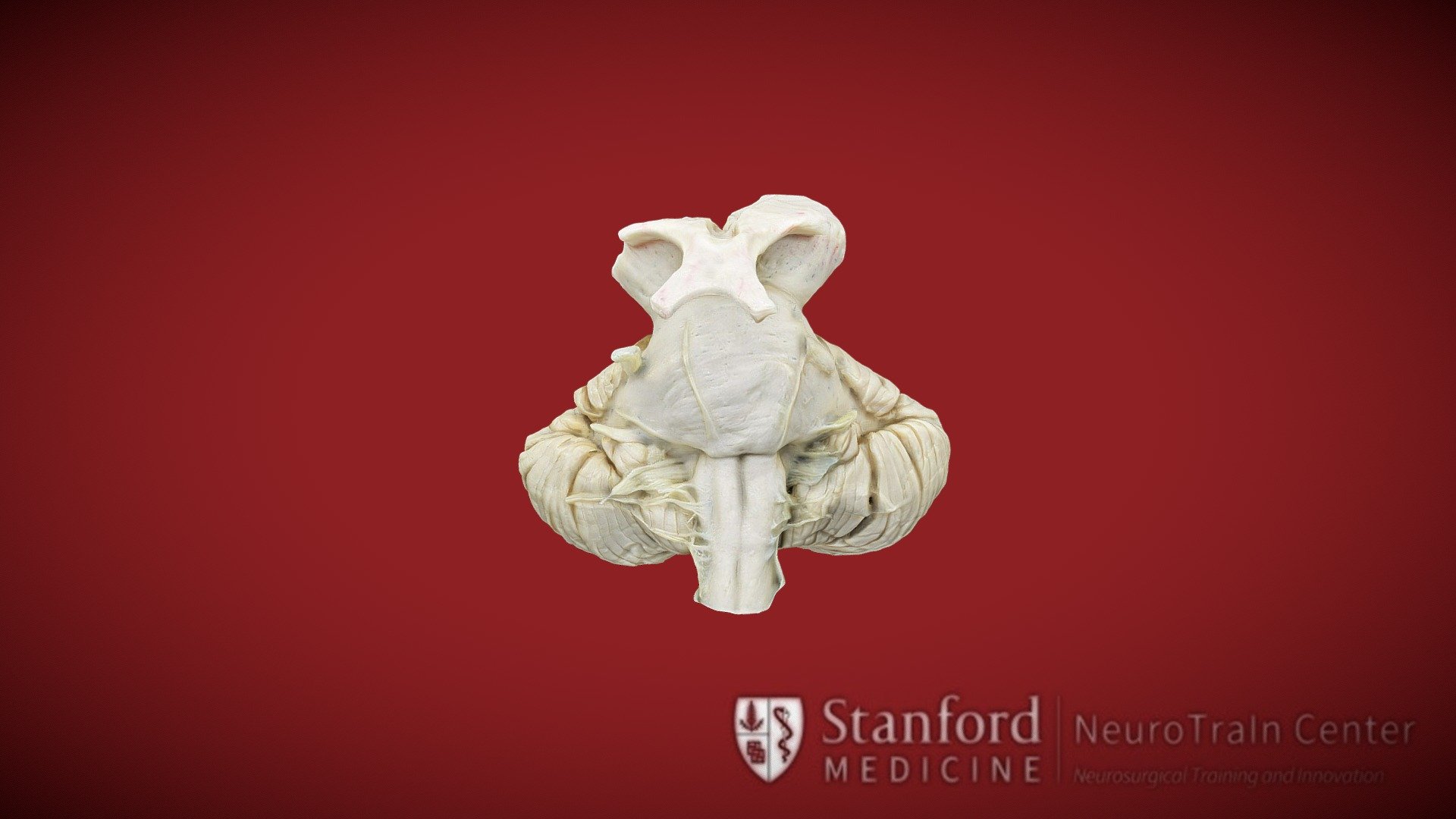 Brainstem and cerebellum - 3D model by vv (@verav) [bd91ed5] - Sketchfab