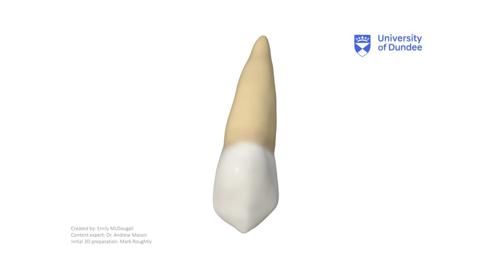 Maxillary Canine