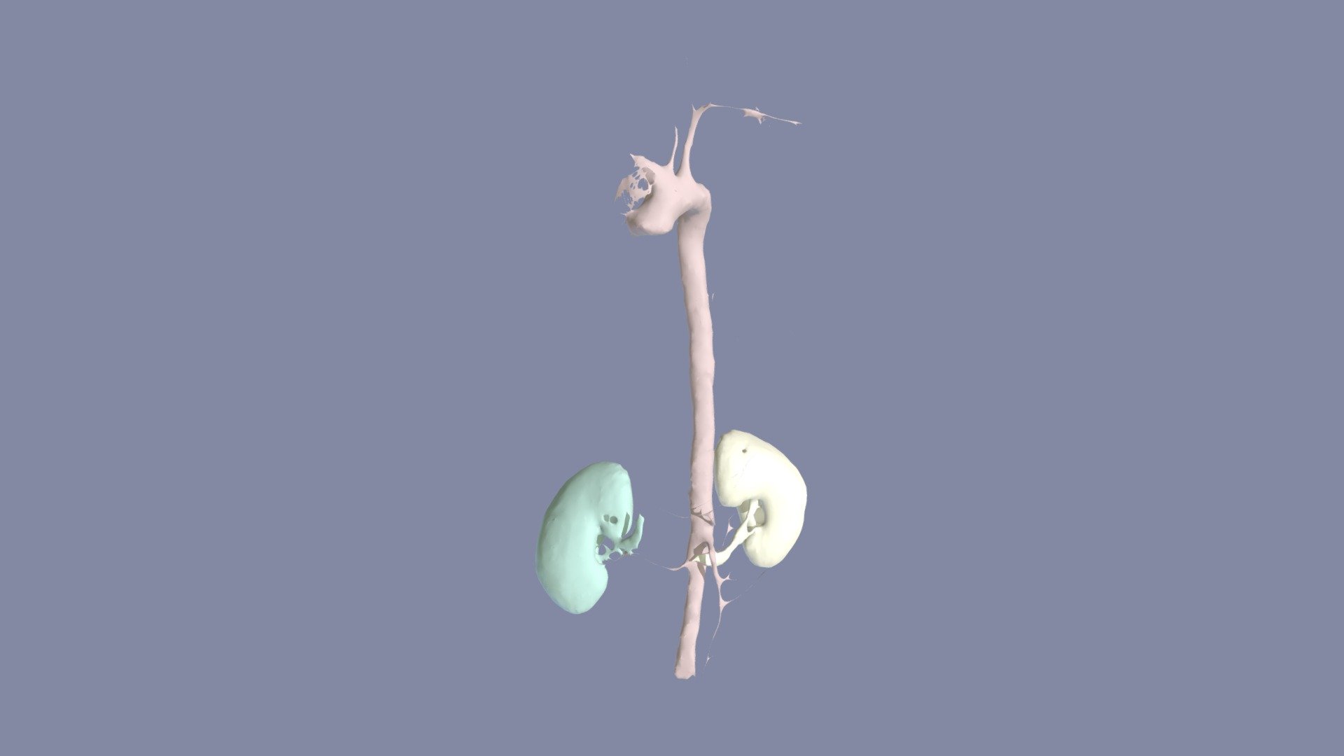 CTACardio Segmentation