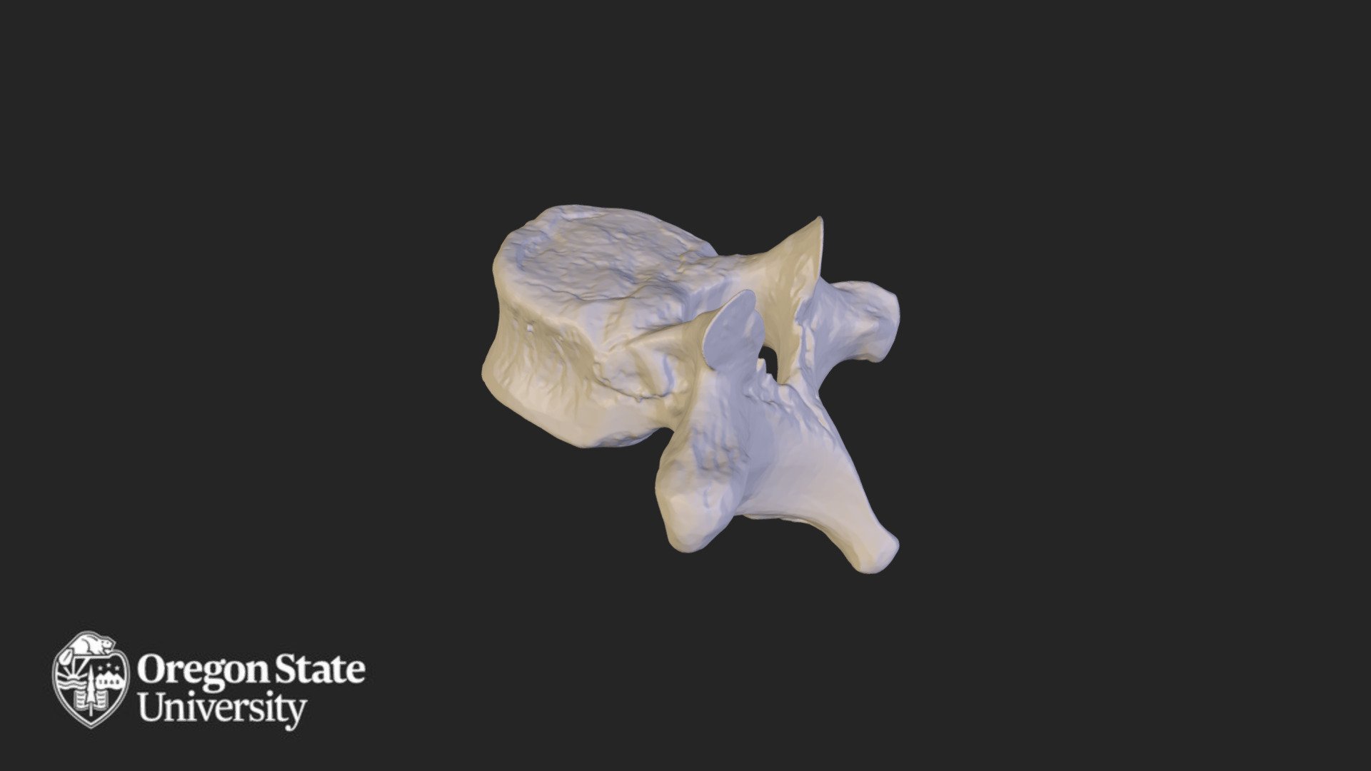 Thoracic vertebra - T10