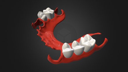 Proteza 3D Model