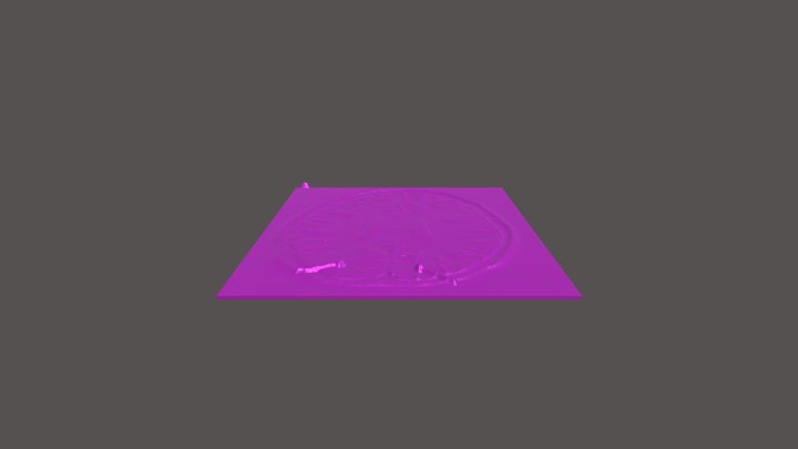 Epiliepsy 3D Model