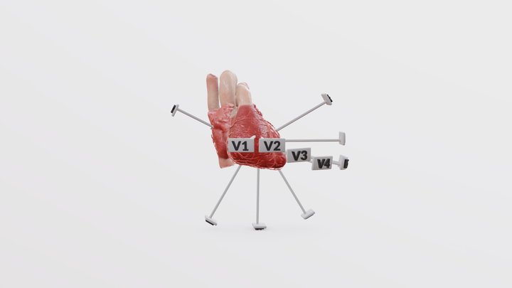 12 Lead ECG 3D Model