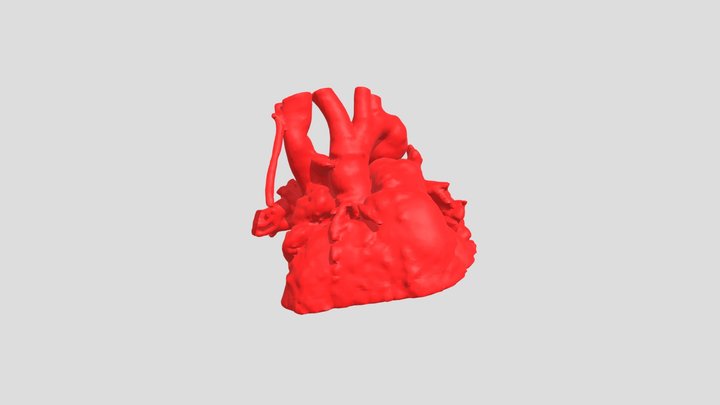 Heart03