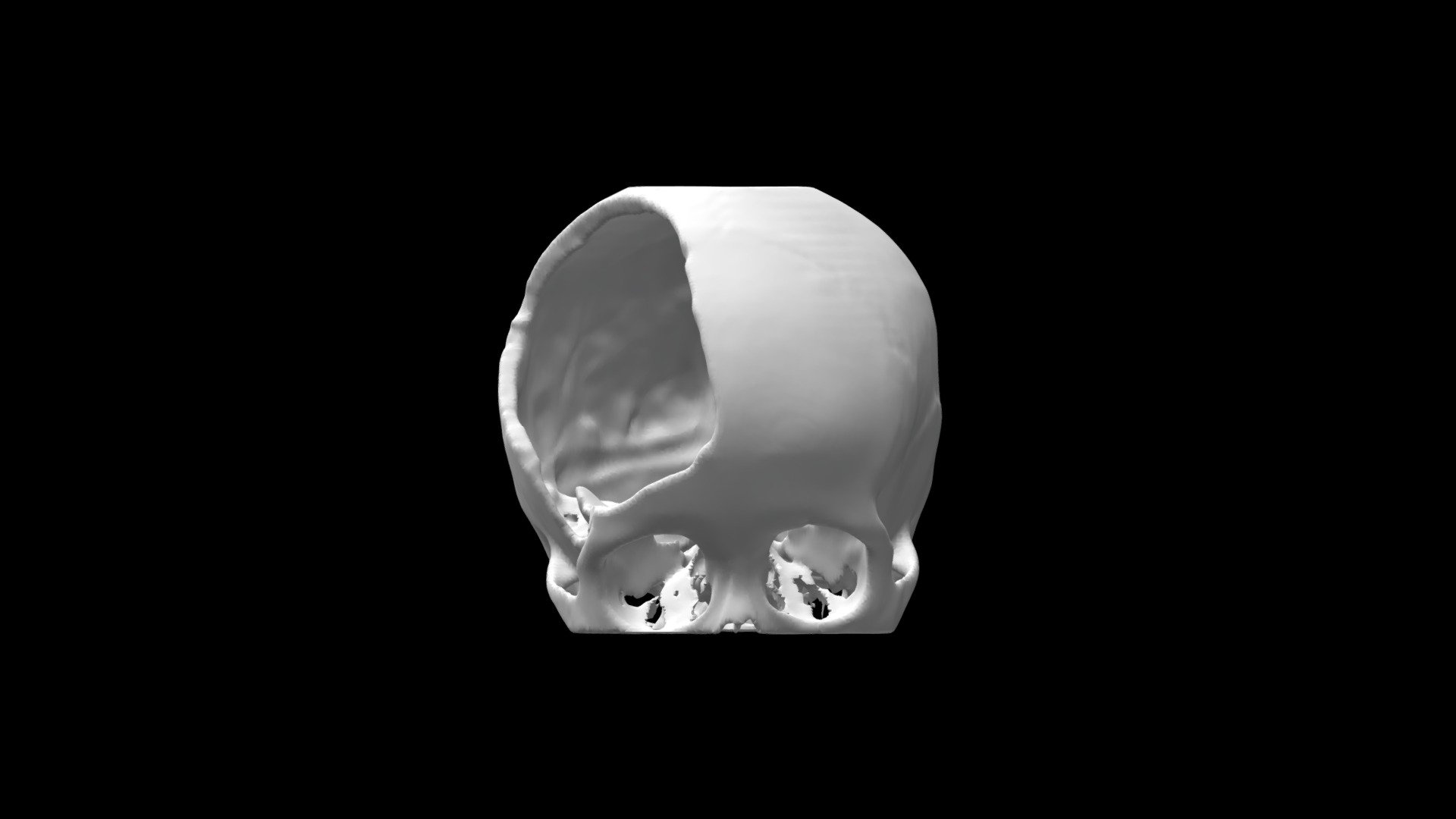 Defect bf323a0d1ae84a769a2f3c09e52d0b53 - 3D model by healthgate ...