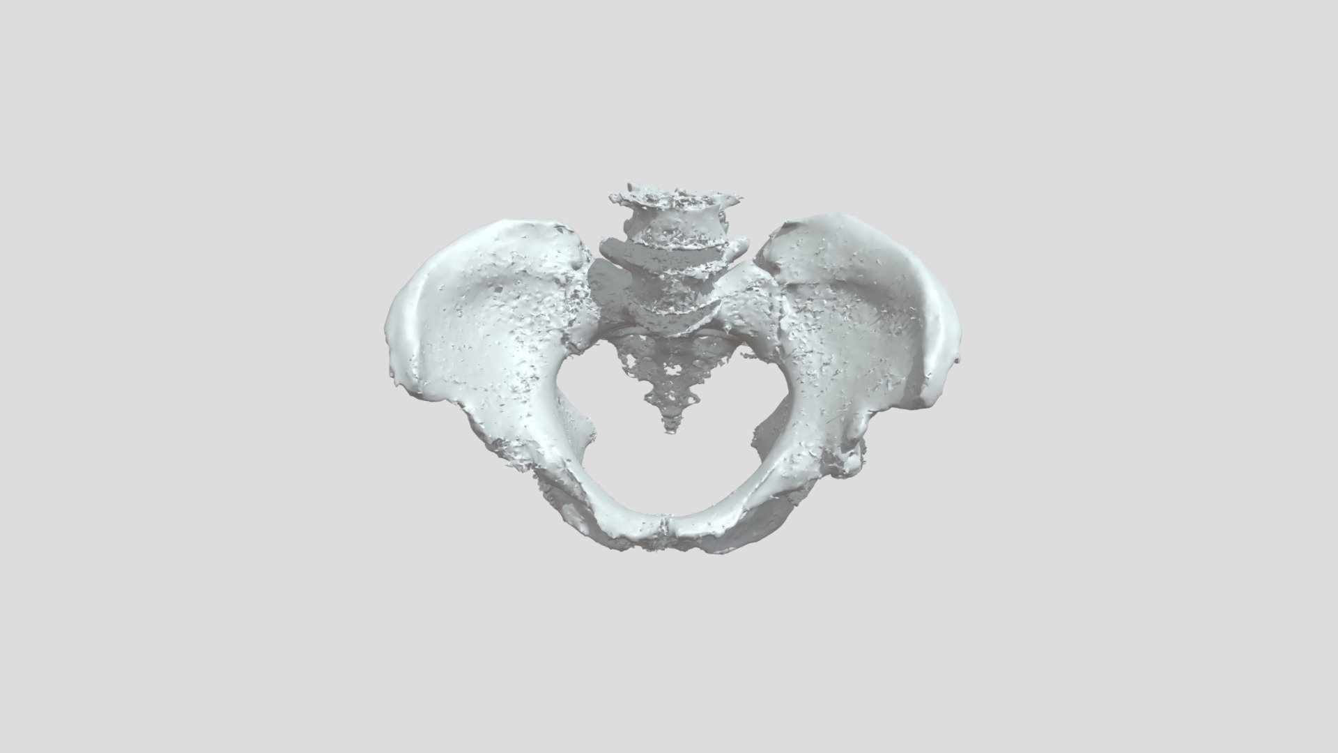 Pelvis (whole), annotated