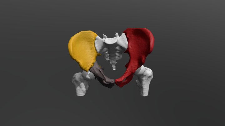 Acetabular 3D models - Sketchfab