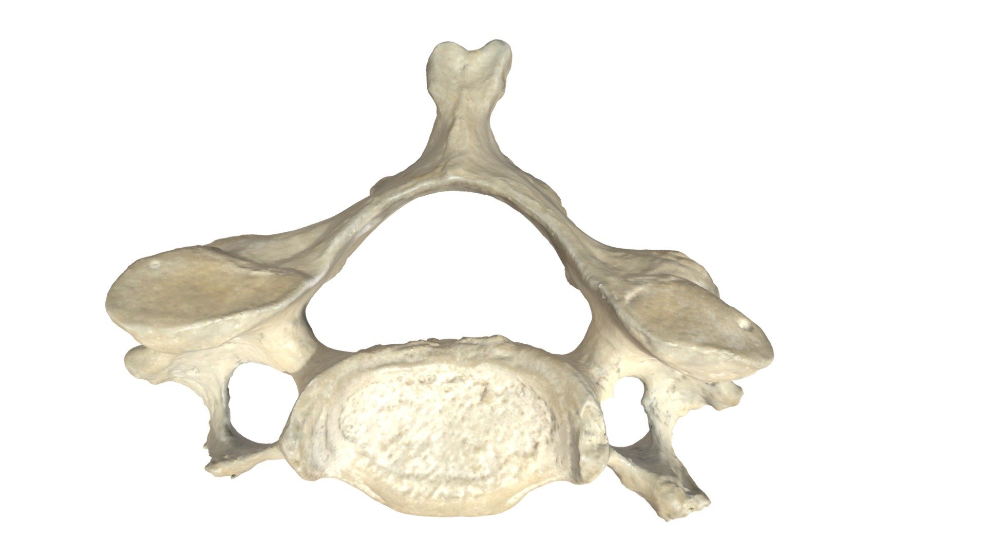 cervicale wervel (C6)-A4 - 3D model by Universiteit Antwerpen ...