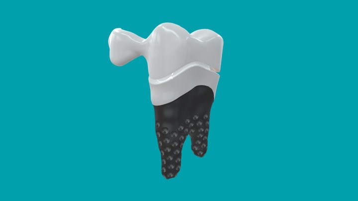 REPLICATE® Tooth 3D Model