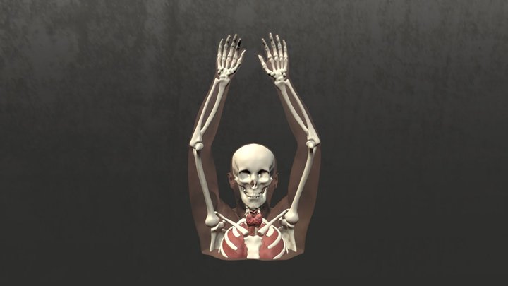 Multinodular Goitre 3D Model