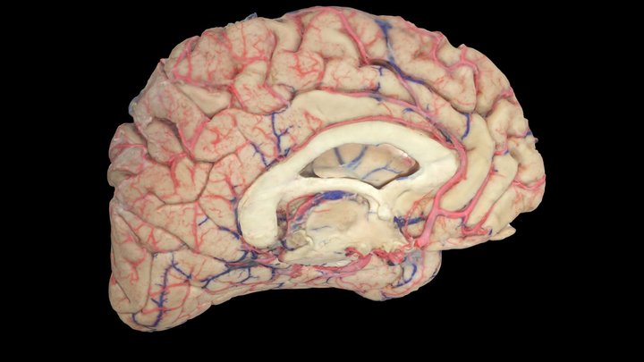 Medial Surface of the brain 3D Model