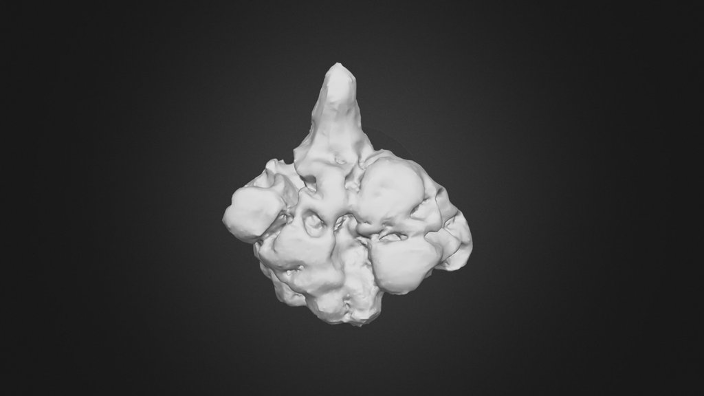 20251124_Hailstone_15