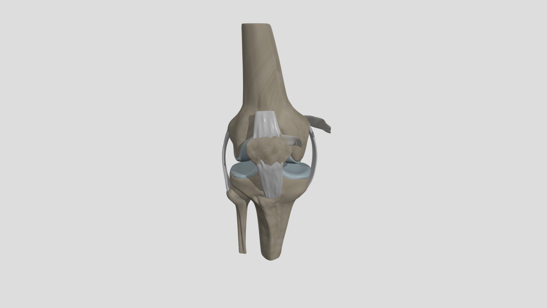 knee mpfl tear - 3D model by jmw2025 [c055edb] - Sketchfab