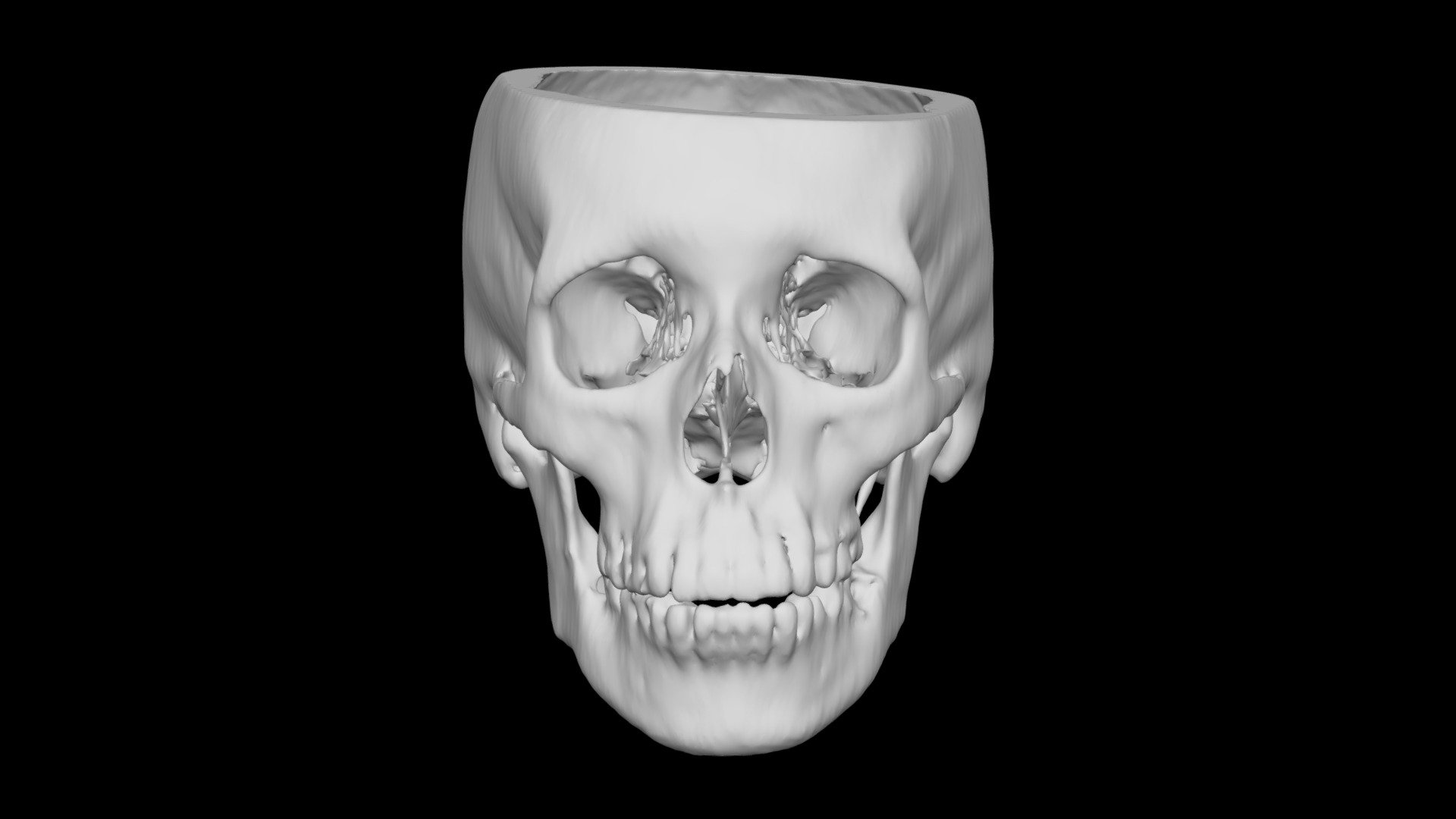 Skull Female 57yo