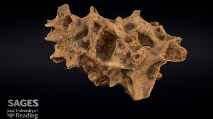 Diseased human vertebra 3D Model