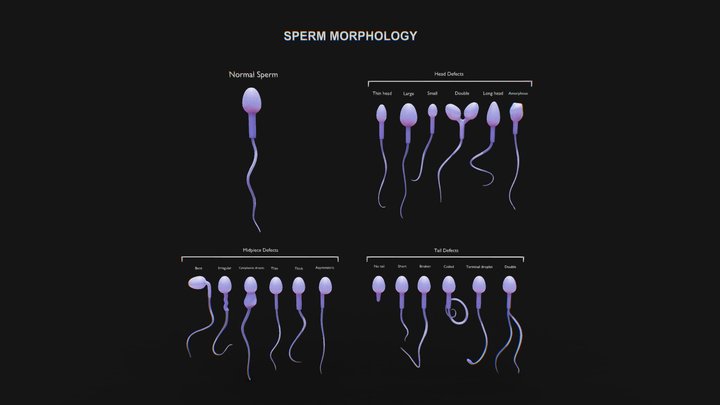 Sperm Morphology: Normal and Abnormal 3D Model