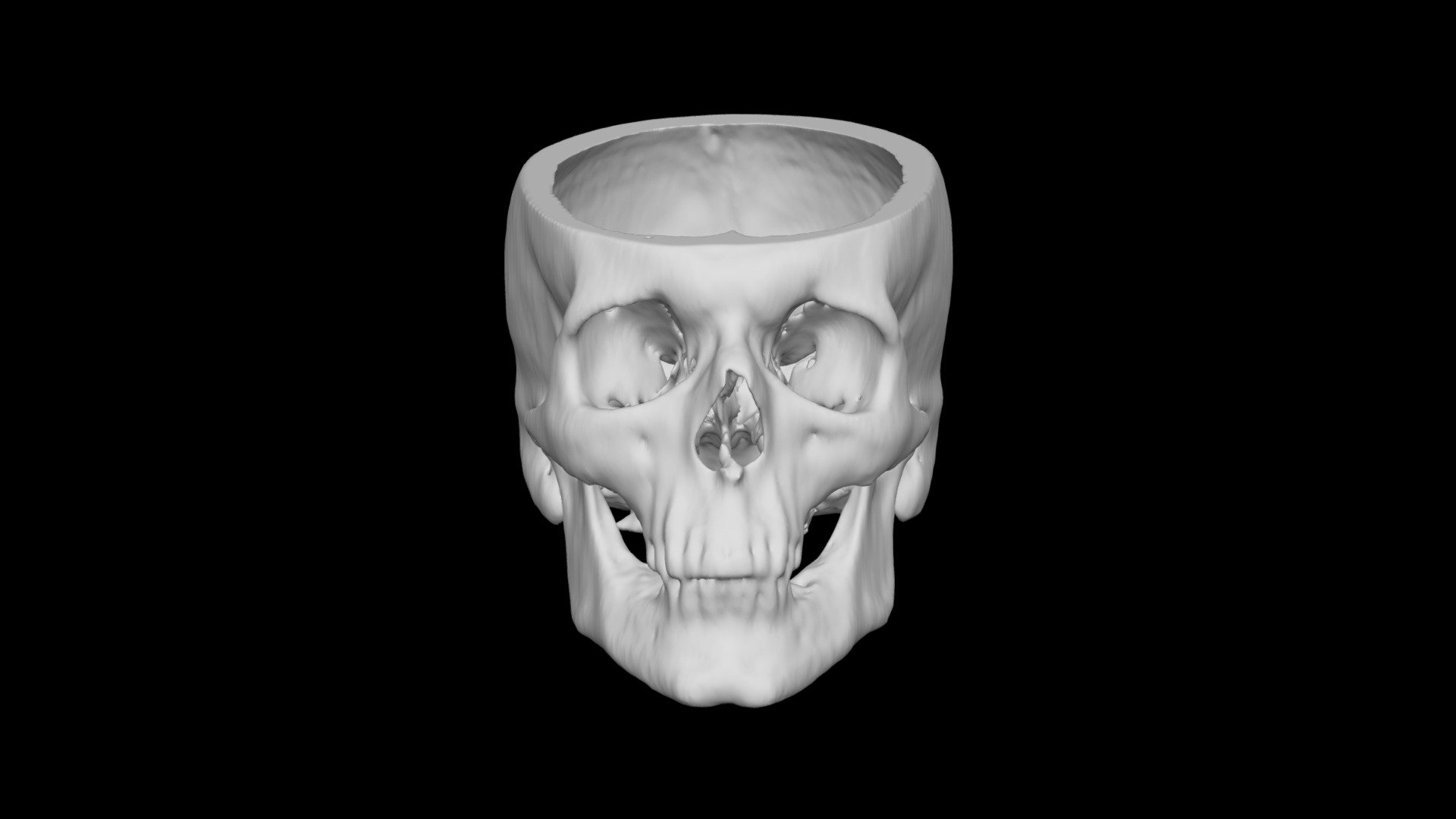 Skull Male 49yo