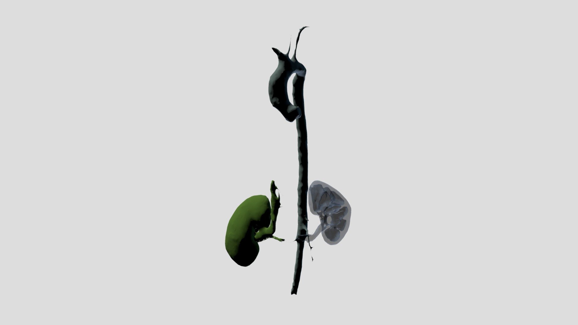 Max CTACardio Segmentation