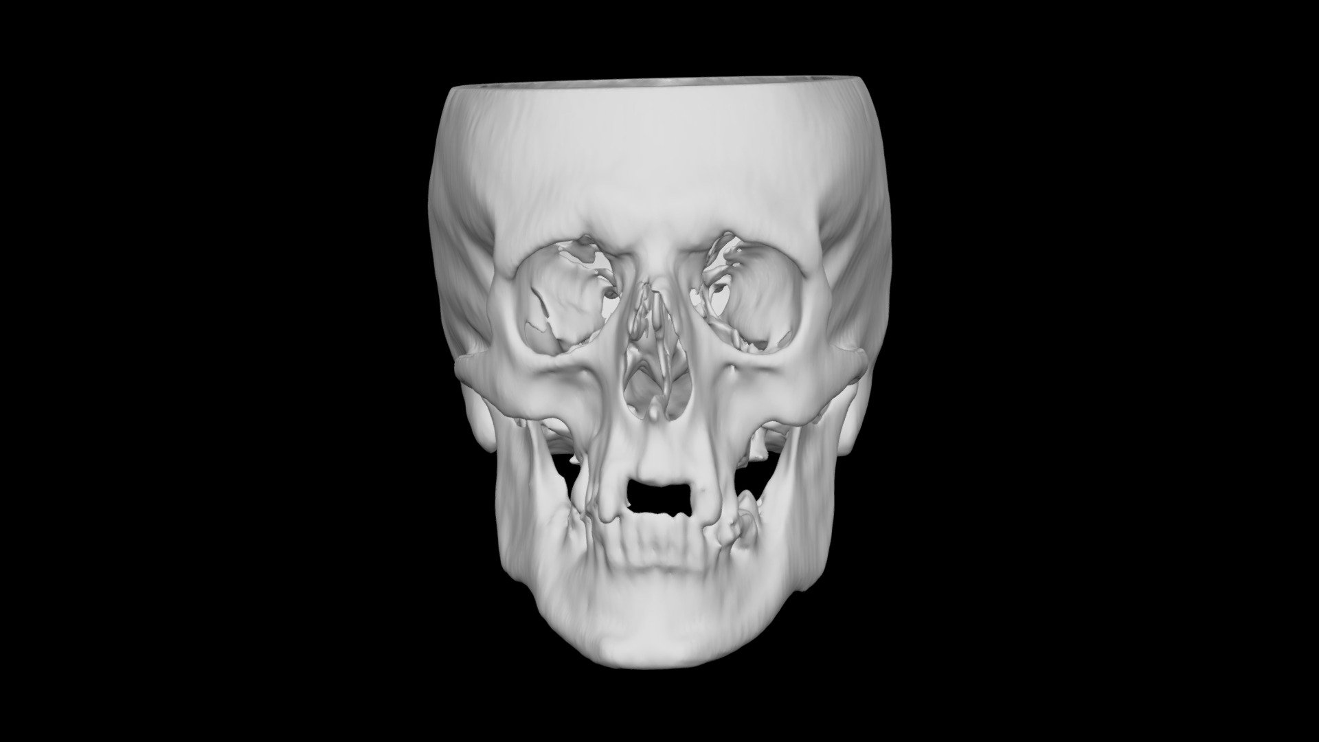Skull Male 51yo