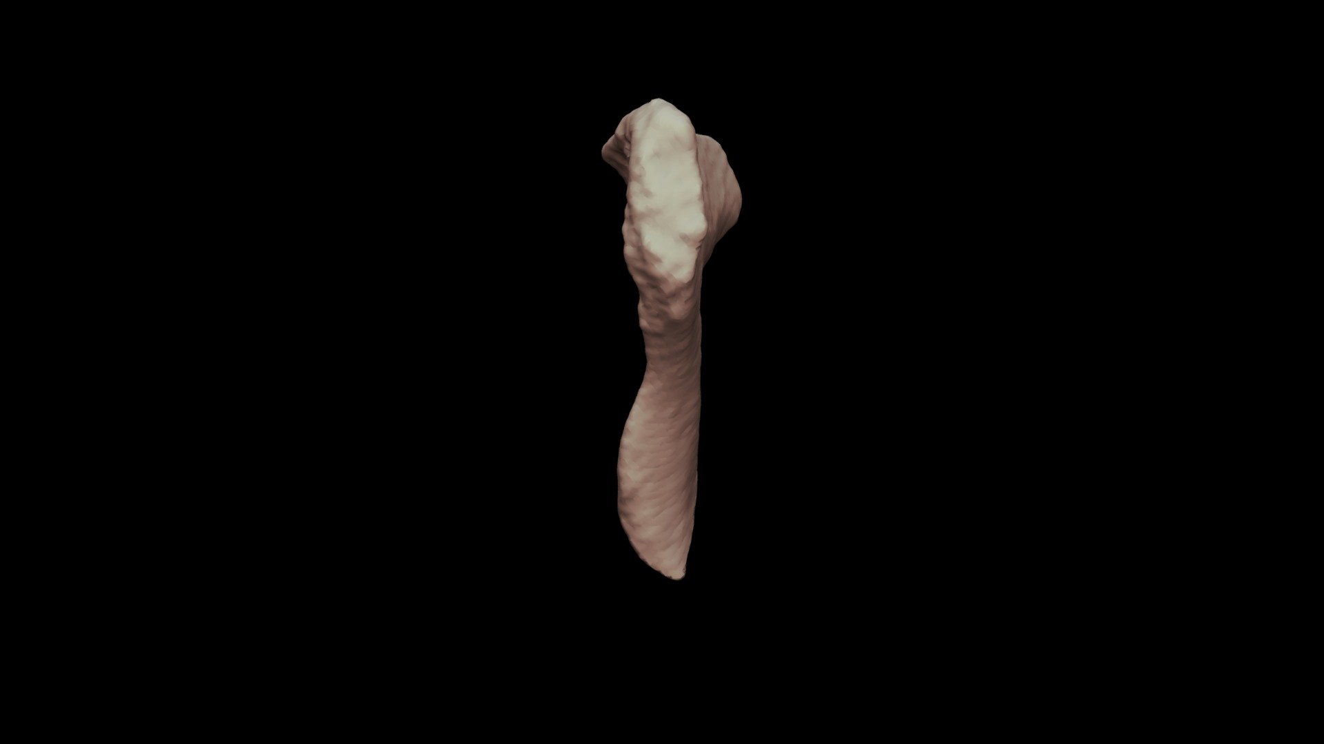 Pubic Symphysis Female 34yo