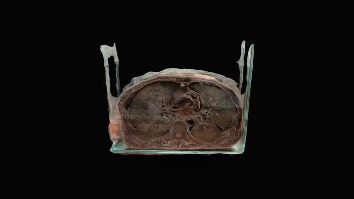 CORTE AXIAL DE TORAX - NIVEL T3-T4 3D Model